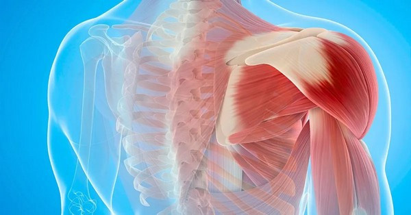 A tartósan feszülő izmok nem jutnak elegendő oxigénhez és tápanyaghoz, ami keringési zavarokhoz, izomgyengüléshez és izomrövidüléshez vezethet.