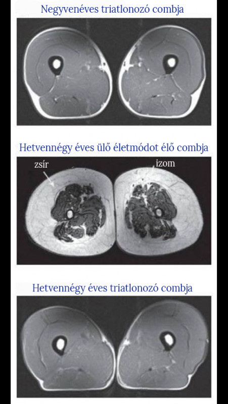 Vetekedhet egy 74 éves ember izomzata egy 40 évesével? Simán! Mutatjuk!